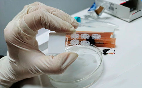 組織冷凍切片機(jī)的選購，需要注意哪些因素