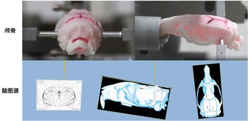  全自動(dòng)腦立體定位儀新升級(jí)~無(wú)需調(diào)平，精準(zhǔn)定位！| 特邀專欄
