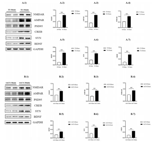 上海體育大學(xué)王曉慧團(tuán)隊(duì)揭示TI刺激促進(jìn)小鼠運(yùn)動技能提升及其機(jī)制