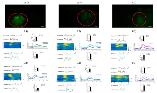 上海體育大學(xué)王曉慧團(tuán)隊(duì)揭示TI刺激促進(jìn)小鼠運(yùn)動技能提升及其機(jī)制