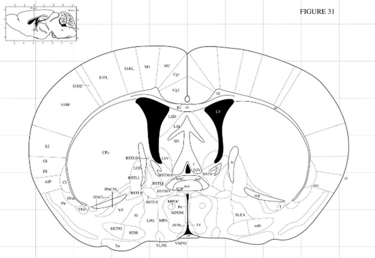 全自動(dòng)腦立體定位儀
