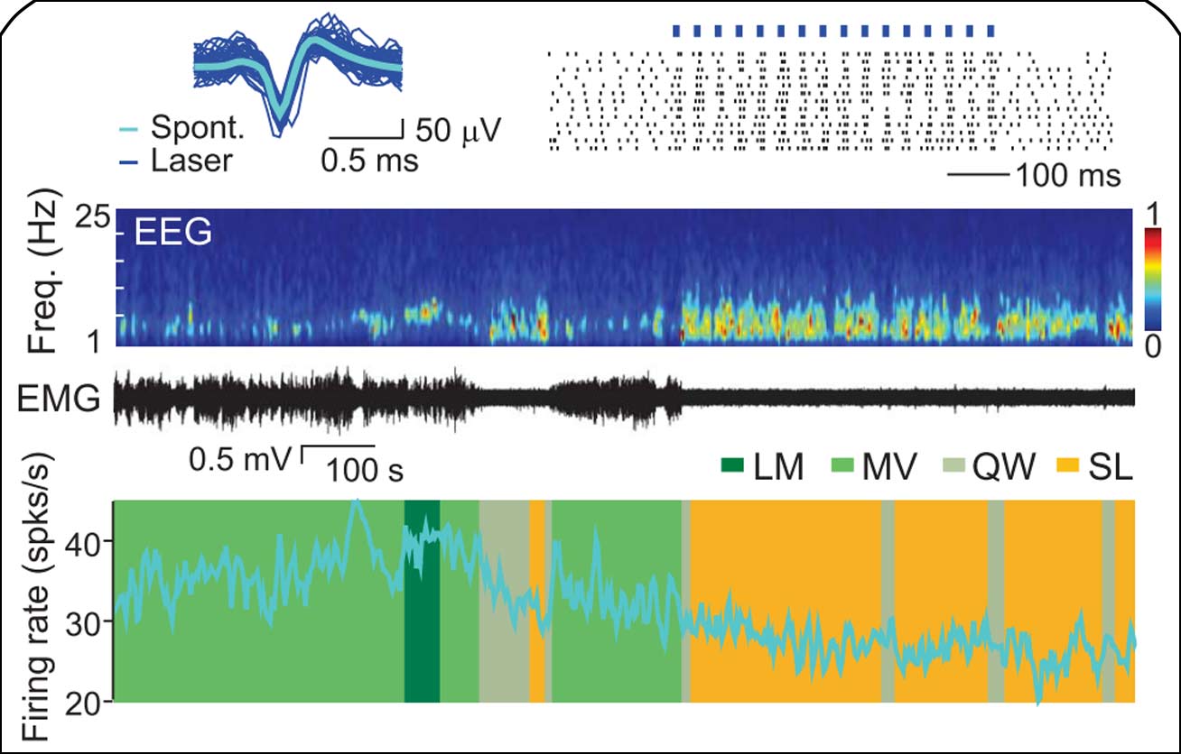 運(yùn)動與睡眠